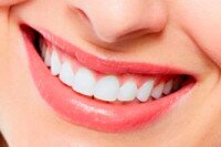 Домашнее отбеливание зубов: зубная щетка против стоматологического кресла